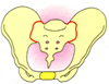 骨盤ケア